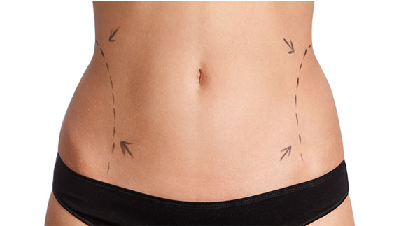Is there tumescent liposuction in Melbourne?